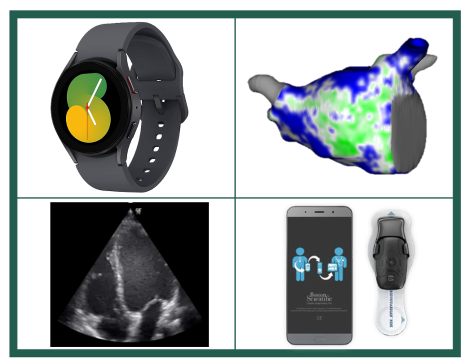 a 4 grid image of a watch, 3D image of a heart, black and white imaging of a heart, and an app on a phone